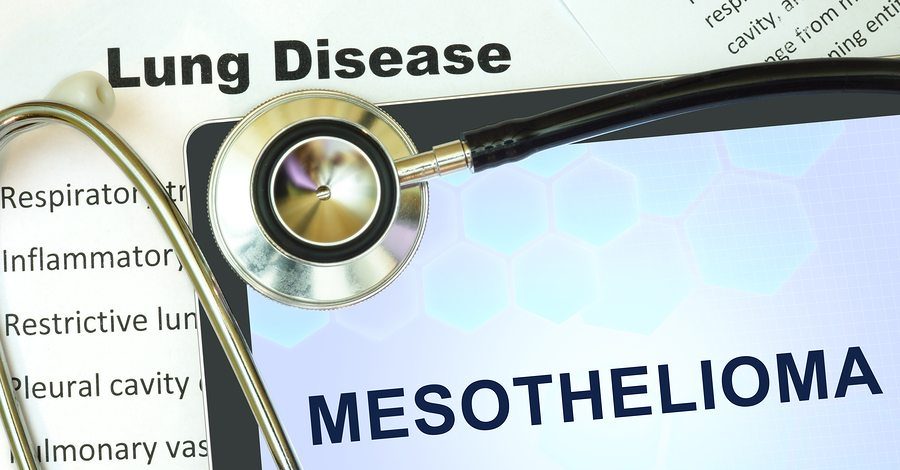 mesothelioma process e1524066786149